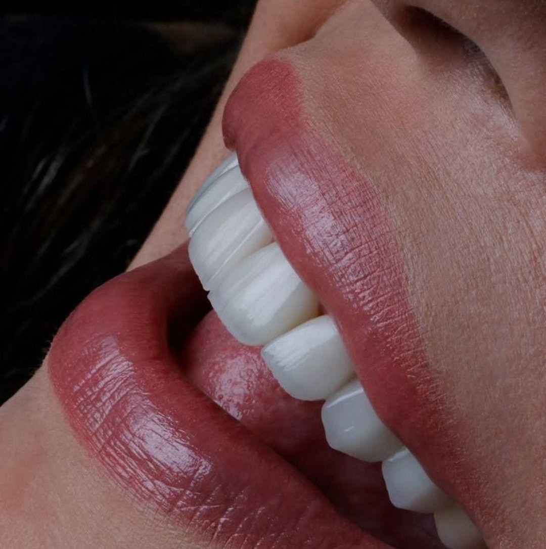 Teeth as Biomarkers for Hidden Disease