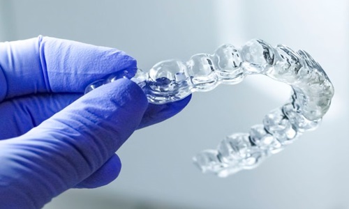 Invisible Aligners in Baner for Teeth Straightening